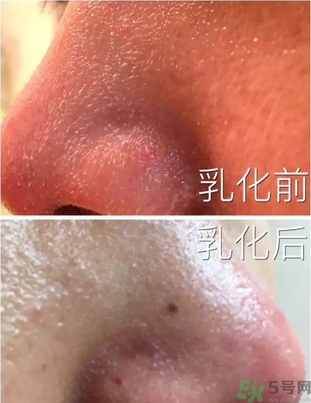 嬌韻詩(shī)吸盤潔面用法圖 嬌韻詩(shī)吸盤使用方法 嬌韻詩(shī)吸盤潔面用法圖 嬌韻詩(shī)吸盤使用方法