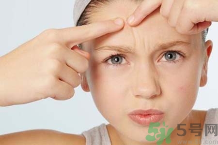 鼻子兩側(cè)長痘的原因是什么？如何去除鼻子兩側(cè)的痘？