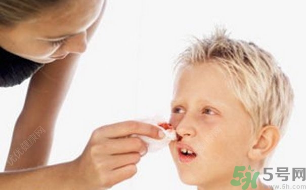 15歲男孩可以刮胡子嗎？15歲男孩經(jīng)常流鼻血怎么回事？