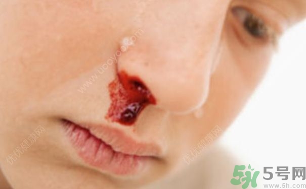 15歲男孩可以刮胡子嗎？15歲男孩經(jīng)常流鼻血怎么回事？