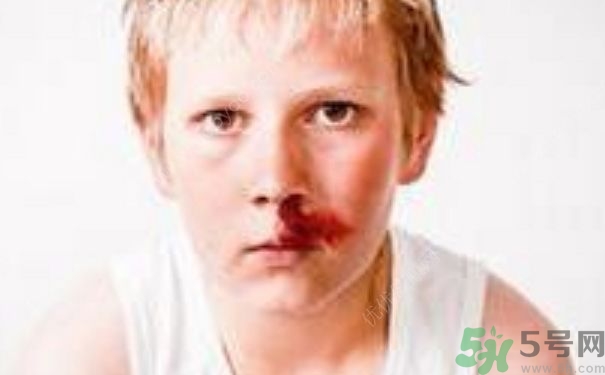 15歲男孩可以刮胡子嗎？15歲男孩經(jīng)常流鼻血怎么回事？