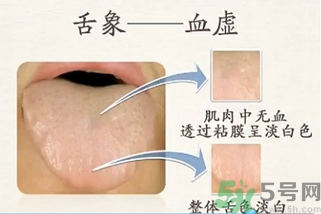 血虛的癥狀是什么？血虛的表現(xiàn)有哪些？