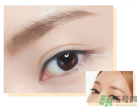 切眉后多久恢復(fù)自然？切眉術(shù)后面部淤青多久才能消？
