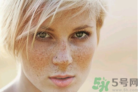 臉上長(zhǎng)雀斑吃什么好？有雀斑不能吃什么？