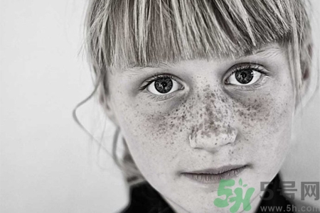 臉上長(zhǎng)雀斑吃什么好？有雀斑不能吃什么？