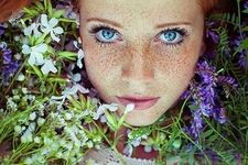 臉上長(zhǎng)雀斑吃什么好？有雀斑不能吃什么？