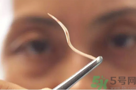 如何避免魚刺卡喉嚨？魚刺卡喉嚨如何處理？