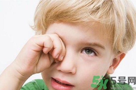 流行性腮腺炎的表現(xiàn)有哪些？?流行性腮腺炎飲食怎么調(diào)理？