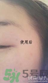 dr.jart適合什么年齡層？蒂佳婷適合年齡