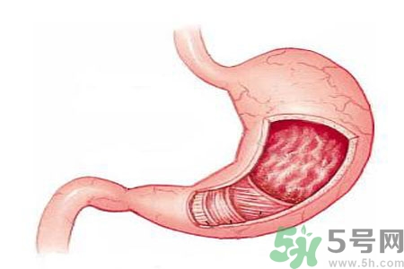 氣虛胃痛是什么？氣虛胃痛的人不能吃什么？