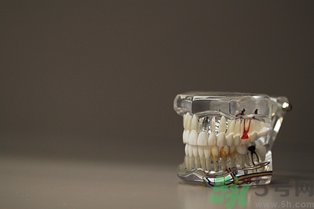 牙周炎有哪些癥狀?得了牙周炎怎么辦 牙周炎有哪些癥狀?得了牙周炎怎么辦