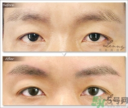 眉毛怎么整形好看？眉毛怎么整自然？