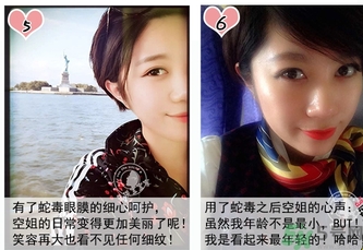 蛇毒眼膜孕婦可以用嗎？ 日本spa蛇毒眼膜孕婦能用嗎？