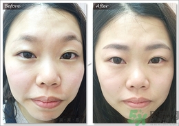 眉毛怎么整形好看？眉毛怎么整自然？