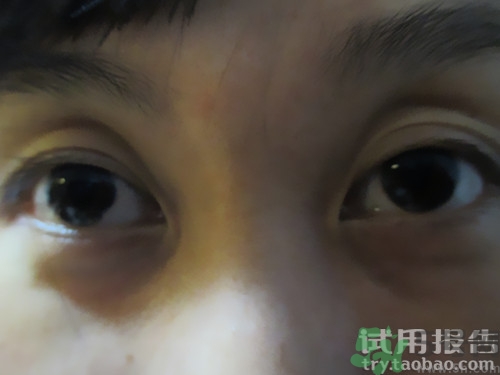 蛇毒眼膜效果怎么樣？spa蛇毒眼膜紅色好用嗎？