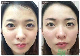 眉毛怎么整形好看？眉毛怎么整自然？