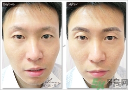 眉毛怎么整形好看？眉毛怎么整自然？