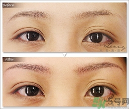 眉毛怎么整形好看？眉毛怎么整自然？