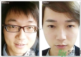 眉毛怎么整形好看？眉毛怎么整自然？