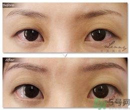 眉毛怎么整形好看？眉毛怎么整自然？