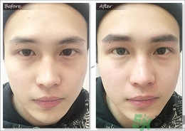 眉毛怎么整形好看？眉毛怎么整自然？