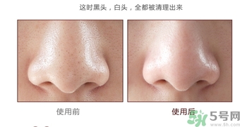 yu.r巧克力棒鼻貼怎么樣？yu.r巧克力鼻貼好用嗎？