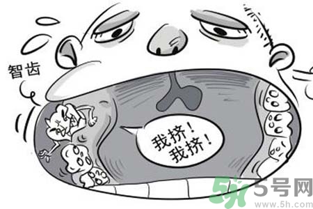 智齒拔了好不好？智齒能不拔嗎？