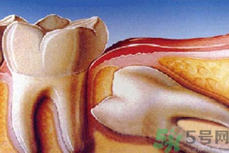 拔智齒一顆多少錢？拔除智齒收費(fèi)多少？