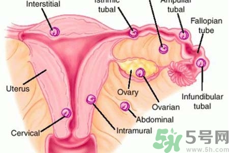 宮外孕手術(shù)后吃什么好？宮外孕手術(shù)后需要注意什么？