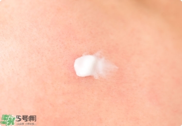 獅王祛痘膏怎么樣？獅王祛痘好用嗎？