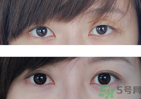 雙眼皮貼怎么貼最自然？雙眼皮貼貼久了會變雙眼皮嗎？