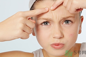 什么樣的痘痘能擠？哪些痘痘不能擠？