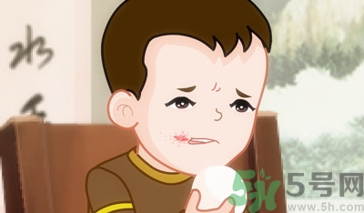 寶寶爛嘴角怎么辦？寶寶爛嘴角的治療方法