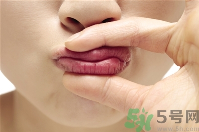孕婦嘴唇干裂脫皮怎么回事？孕婦嘴唇干裂脫皮是缺什么