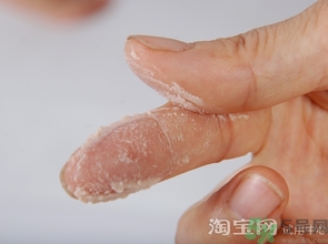gnc葡萄籽膠囊什么時候吃效果最好? gnc葡萄籽膠囊什么時候吃效果最好?