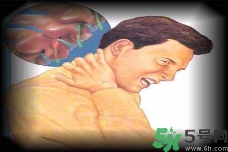 肩頸痛怎么回事？肩頸痛怎么辦？