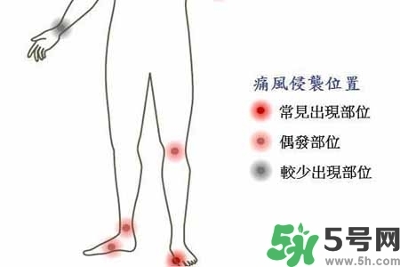 引發(fā)痛風(fēng)的原因是什么？痛風(fēng)病人飲食需注意什么好？