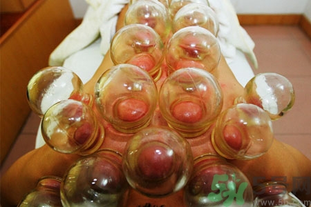 月經(jīng)可以拔火罐嗎？經(jīng)期可以拔火罐嗎？