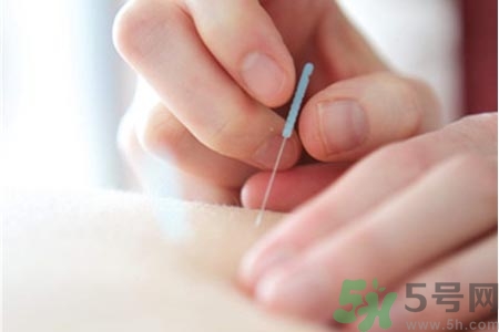 針灸一次要扎多長時間？針灸可以幾天做一次？