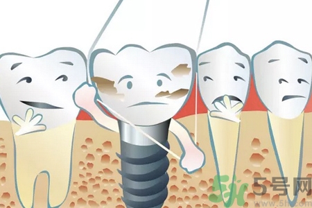 牙線對牙齒好嗎？牙線怎么正確使用？