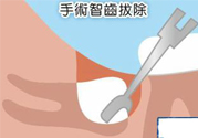 智齒拔完后有個(gè)洞怎么辦？拔智齒后有個(gè)洞多久能長(zhǎng)好？