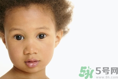 小孩皮膚黑怎么回事？小孩皮膚黑怎么變白？