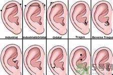 過敏體質(zhì)能打耳洞嗎？疤痕體質(zhì)可以穿耳洞嗎？