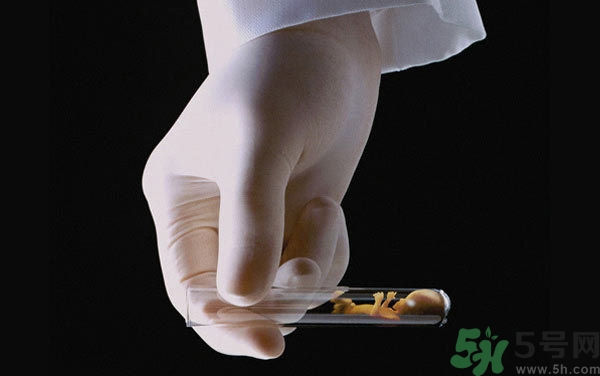 做試管嬰兒要多長(zhǎng)時(shí)間？做試管嬰兒可以選擇性別？