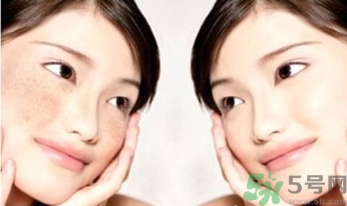 色斑分為哪幾種？有色斑該多吃什么好？