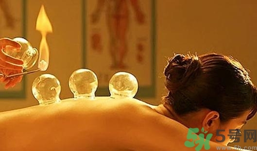 在家拔罐需要注意什么？在家拔罐幾天拔一次？