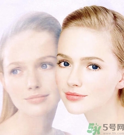 曬斑可以自己消退嗎？曬斑可以用激光去除嗎？