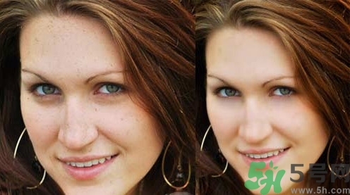 色斑會(huì)自己消失嗎？色斑遺傳嗎？