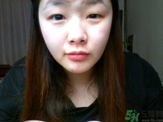 天生腫眼泡怎么消除？天生腫眼泡怎么辦？