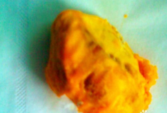 雞蛋果怎么吃？雞蛋果的籽可以吃嗎？